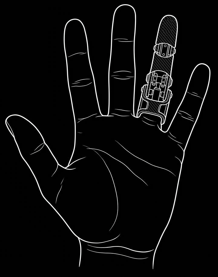 Finger prosthesis sketch